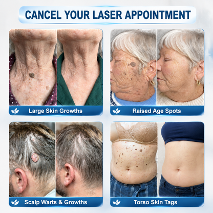 𝐏𝐡𝐚𝐫𝐦𝐚𝐜𝐢𝐬𝐭 𝐑𝐞𝐜𝐨𝐦𝐦𝐞𝐧𝐝𝐞𝐝 🥔𝑯𝗲𝙖𝐥𝒓𝗶𝙯𝗲® 7-𝐷𝑎𝑦 𝗧𝐚𝐠 & 𝗦𝗽𝐨𝐭 𝐄𝐫𝒂𝒔𝒆𝒓🪄(Zero 𝐏𝐚𝐢𝐧, Zero 𝐒𝐜𝐚𝒓𝒔 Rollerball)👩‍⚕️